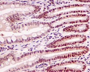 Immunohistochemical analysis of paraffin embedded Human colon tissue labeling MLF2 with ab180184 at 1/50.
