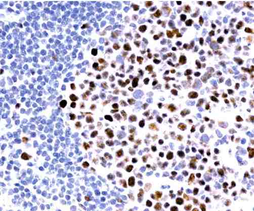 Formalin fixed paraffin embedded human tonsil stained with MLH1 using ABC and DAB chromogen.