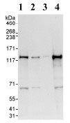 All lanes : Anti-MLK4 antibody (ab93798) at 0.04 µg/mlLane 1 : HeLa whole cell lysate at 50 µgLane 2 : HeLa whole cell lysate at 15 µgLane 3 : HeLa whole cell lysate at 5 µgLane 4 : 293T whole cell lysate at 50 µgdeveloped using the ECL technique