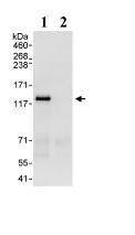 Detection of MLK4 in Immunoprecipitates of HeLa whole cell lysate (1 mg for IP, 20% of IP loaded) using ab93798 at 3 µg/mg lysate for IP (Lane 1) and at 1 µg/ml for subsequent Western blot detection. Lane 2 represents control IgG IP. Detection: Chemiluminescence with an exposure time of 3 seconds.