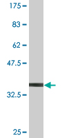 Anti-MLKL antibody (ab118348) at 5 µg/ml + Immunizing peptide at 0.2 µg