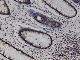 ab118348, at 3 µg/ml staining MLKL in formalin-fixed, paraffin-embedded Human colon tissue by Immunohistochemistry.