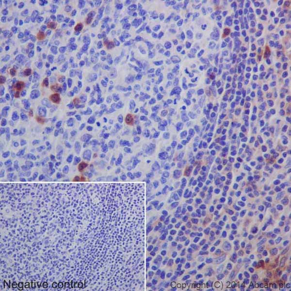 Immunohistochemical analysis of paraffin-embedded Human tonsil tissue labeling MLKL with ab184718 at 1/400 dilution, followed by Goat Anti-Rabbit IgG H&L (HRP) secondary antibody (ab97051) at 1/500 dilution. Cytoplasmic staining on the lymphocytes of human tonsil is observed. Counter stained with Hematoxylin.Negative control: Using PBS instead of primary antibody, secondary antibody is Goat Anti-Rabbit IgG H&L (HRP) (ab97051) at 1/500 dilution.