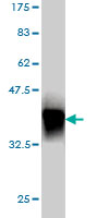 Western blot against tagged recombinant protein immunogen using ab56629 MLT5 antibody at 1ug/ml.