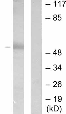 All lanes : Anti-MMP1 antibody (ab53142) at 1/500 dilutionLane 1 : HepG2 cell extracts minus immunising peptideLane 2 : HepG2 cell extracts plus immunising peptide