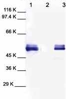 All lanes : Anti-MMP1 antibody (ab38924) at 1/1000 dilutionLane 1 : Human MMP 1Lane 2 : Cell media from Human chondrosarcoma (no treatment)Lane 3 : Cell media from Human chondrosarcoma (treated with TPA)Performed under reducing conditions.