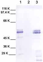 All lanes : Anti-MMP1 antibody (ab38928)Lane 1 : Human MMP1.Lane 2 : Cell Media from human chondrosarcoma (no treatment).Lane 3 : Cell Media from human chondrosarcoma (treated with TPA).