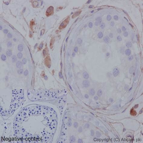 Immunohistochemistry (Formalin/PFA-fixed paraffin-embedded sections) analysis of human testis tissue labelling MMP1 with unpurified ab52631 at 1/60. Heat mediated antigen retrieval was performed using Tris/EDTA buffer pH 9. A prediluted HRP-polymer conjugated anti-rabbit IgG was used as the secondary antibody. Negative control using PBS instead of primary antibody. Counterstained with hematoxylin.