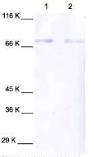 Lane 1 :  Anti-MMP2 antibody (ab38917) (Human MMP2)Lane 2 :  Cell Media from human dermal fibroblasts (neonatal and treated with IL1 beta)Lane 1 : As aboveLane 2 : As above