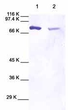 All lanes : Anti-MMP2 antibody (ab38919) at 1/1000 dilutionLane 1 : Human MMP2Lane 2 : Cell Media from human dermal fibroblasts (neonatal) treated with IL1 beta