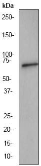 Anti-MMP2 antibody [EP1329Y] (ab51127) at 1/500 dilution + Recombinant protein, 10ngSecondaryGoat anti-rabbit HRP labeled at 1/2000 dilution