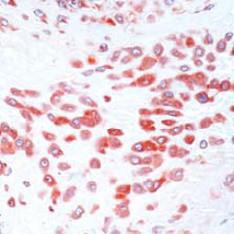 Ab54401 staining human MMP2 in human placenta tissue by immunohistochemistry using formalin fixed, paraffin embedded tissue.