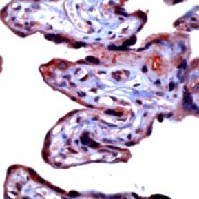 Ab32607, at a 1/50 dilution, staining MMP3 in formalin fixed paraffin embedded human placenta tissue by Immunohistochemistry.