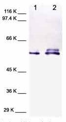 All lanes : Anti-MMP3 antibody [4B7.3] (ab38907) at 1/1000 dilutionLane 1 : Human MMP3Lane 2 : Cell media from human chondrosarcoma (treated with TPA)