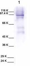 Anti-MMP9 antibody (ab38898) + Human MMP9Observed band size : 88,92 kDa (why is the actual band size different from the predicted?)Ab38898 detects a band at 92 Kd (pro-form) and a band at 88 Kd (active form). Mouse MMP9 is slightly larger than human MMP9, and the antibody detects a band at about 105 Kd. It is recommend to concentrate samples by Gelatin-agarose affinity chromatography prior to Western blot usage. A recommended starting concentration for Western blots is 1:1000 when using colorimetric substrates such as BCIP/NBT, and 1:5000 for chemiluminescent substrates. Higher concentration of antibody may be needed for non-human samples.