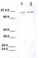 All lanes : Anti-MMP9 antibody (ab38902)Lane 1 : Human MMP9Lane 2 : Cell media from human chondrosarcoma (untreated)
