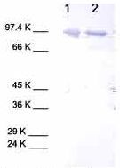 All lanes : Anti-MMP9 antibody (ab38899)Lane 1 : Human MMP9Lane 2 : Cell media from human chondrosarcoma (untreated)
