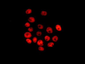 Immunofluorescence analysis of A431 cells, labeling MNAT1 using ab171965 at a 1/250 dilution.