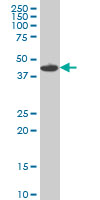 Anti-MNK1 antibody (ab89223) at 5 µg/ml + Raw 264.7 cell lysate at 50 µgdeveloped using the ECL technique
