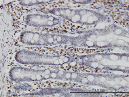 ab89223, at 3 µg/ml, staining MNK1 in formalin fixed, paraffin embedded human small intestine tissue by Immunoperoxidase/Immunohistochemistry.