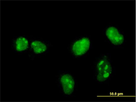 ab89223, at 10 µg/ml, staining MNK1 in paraformaldehyde fixed, permeabilised HeLa cell by Immunofluorescence.