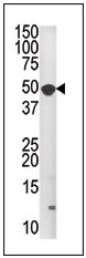 Anti-MNK1 antibody (ab60204) at 1/100 dilution + A2058 tissue lysate