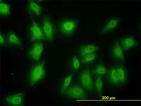 ab117545 at 10µg/ml dilution staining MNK1 in HeLa cells by Immunofluorescence.