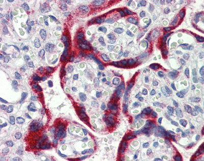 ab84345 at 5 µg/ml staining MNK2 in Human Placenta tissue by Immunohistochemistry (Formalin/PFA-fixed paraffin-embedded sections).