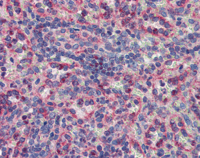 ab84345 at 5 µg/ml staining MNK2 in Human spleen tissue by Immunohistochemistry (Formalin/PFA-fixed paraffin-embedded sections).