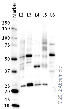 All lanes : Anti-MNK2 antibody (ab84345) at 1 µg/mlLane 1 : MarkerLane 2 : Zebrafish brain homogenate at 20 µgLane 3 : Zebrafish heart homogenate at 10 µgLane 4 : Zebrafish liver homogenate at 10 µgLane 5 : Zebrafish skeletal muscle homogenate at 10 µgLane 6 : HeLa (Human epithelial carcinoma cell line) Whole Cell Lysate at 10 µgSecondaryGoat polyclonal to Rabbit IgG – H&L – Pre-Adsorbed (HRP) at 1/6000 dilutiondeveloped using the ECL techniquePerformed under reducing conditions.