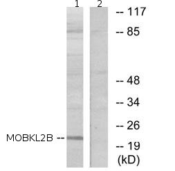All lanes : Anti-MOBKL2B antibody (ab72759) at 1/500 dilutionLane 1 : Extracts from COLO cells Lane 2 : Extracts from COLO cells with immunising peptide at 5 µgLysates/proteins at 5 µg per lane.