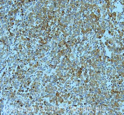 IHC image of ab72759 staining in human normal colon formalin fixed paraffin embedded tissue section, performed on a Leica BondTM system using the standard protocol F. The section was pre-treated using heat mediated antigen retrieval with EDTA (pH9, epitope retrieval solution 2) for 20 mins. The section was then incubated with ab72759, 5µg/ml, for 15 mins at room temperature and detected using an HRP conjugated compact polymer system. DAB was used as the chromogen. The section was then counterstained with haematoxylin and mounted with DPX.For other IHC staining systems (automated and non-automated) customers should optimize variable parameters such as antigen retrieval conditions, primary antibody concentration and antibody incubation times.