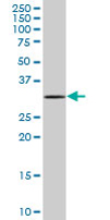 Anti-MOBKL2C antibody (ab67840) at 1/500 dilution + human pancreas tissue lysate at 25 µgSecondaryGoat Anti-Mouse IgG (H&L)-HRP Conjugate at 1/2500 dilution