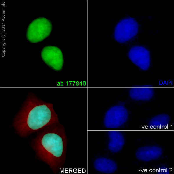 Immunofluorescent analysis of 4% paraformaldehyde-fixed, 0.1% Triton X-100 permeabilized HeLa cells labeling Histone H4 with ab177840 at 1/100 dilution, followed by Goat anti-rabbit IgG (Alexa Fluor® 488) (ab150077) secondary antibody at 1/400 dilution (green). Nuclear staining on HeLa cell line is observed. The nuclear counter stain is DAPI (blue). Tubulin is detected with ab7291 (anti-Tubulin mouse mAb) at 1/500 dilution and ab150120 (AlexaFluor®594 Goat anti-Mouse secondary) at 1/500 dilution (red).The negative controls are as follows:1. ab177840 at 1/100 dilution followed by ab150120 (AlexaFluor®594 Goat anti-Mouse secondary) at 1/500 dilution.2. ab7291 (anti-Tubulin mouse mAb) at 1/500 dilution followed by ab150077 (Alexa Fluor®488 Goat Anti-Rabbit IgG H&L) at 1/400 dilution.