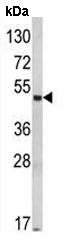 Anti-MOK protein kinase antibody (ab135623) at 1/100 dilution + Mouse liver tissue lysate at 35 µgdeveloped using the ECL technique