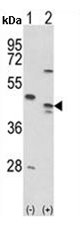 All lanes : Anti-MOK protein kinase antibody (ab135623) at 1/100 dilutionLane 1 : 293 cell lysate, non-transfected Lane 2 : 293 cell lysate, transiently transfected with the MOK protein kinase gene Lysates/proteins at 2 µg per lane.developed using the ECL technique