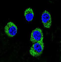 Confocal immunofluorescent analysis of MDA-MB231 cells labelling MOK protein kinase with ab135623 at 1/10 dilution followed by Alexa Fluor 488-conjugated goat anti-rabbit lgG (green). DAPI was used to stain the cell nuclear (blue).