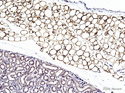 Immunohistochemical staining of Monoacylglycerol Lipase using ab77398 on Formaldehyde-fixed paraffin-embedded mouse adipose tissue sections (from around the kidney). Antigen retrieval step: heat mediated in citric acid HIER. Blocking step: 1% BSA for 10 mins @ rt°C. ab77398 incubated at 1/500 for 2 hours. Secondary Antibody: biotin labelled anti goat IgG used at 1/200. The submitted image shows white fat deposits around the kidney. Dilution factors vary between 1/300-500. There is a pale positivity in the renal tubular cytoplasm which appears to be specific (at lower dilution factor this is more obvious but, in this block the fat was too strongly immunostained). Section was endogenous biotin-blocked prior to incubation with primary Ab.See Abreview