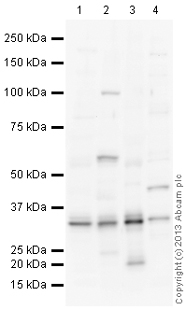 All lanes : Anti-Monoacylglycerol Lipase antibody (ab152002) at 1 µg/mlLane 1 : Heart (Human) Tissue Lysate - adult normal tissueLane 2 : Liver (Human) Tissue Lysate - adult normal tissueLane 3 : Adipose (Human) Total Protein Lysate - adult normal tissueLane 4 : Adult Mouse Brown Adipose Tissue Tissue LysateLysates/proteins at 10 µg per lane.SecondaryGoat Anti-Rabbit IgG H&L (HRP) (ab97051) at 1/10000 dilutiondeveloped using the ECL techniquePerformed under reducing conditions.