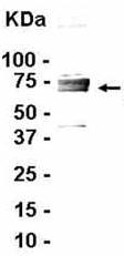 Anti-Monoacylglycerol Lipase antibody (ab37652) at 1/2000 dilution + E coli derived fusion protein at 2.5 µgSecondaryGoat anti IgY HRP at 1/1000 dilutiondeveloped using the ECL technique