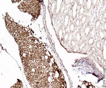 ab24701 in 1/200 dilution staining Monoacylglycerol Lipase in mouse visceral adipose tissue: The large "holes" indicate the presence of the white adipocytes as they accumulate fat stores in one lipid droplet that fills the whole cell thus pushing the cytoplasm to the periphery only, whereas brown adipocytes accumulate cytoplasmic lipid in multiple droplets. The tissue to the right is the hilus of mouse kidney and is substantially negative for this Ab reagent.See Abreview