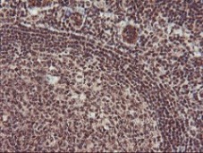 ab119777, at 1/150 dilution, staining Monoacylglycerol Lipase in paraffin-embedded Human tonsil tissue by Immunohistochemistry.