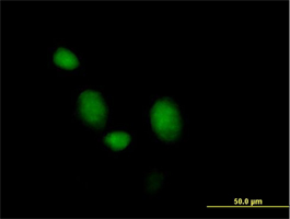 Immunofluorescence of HeLa cells labeling Morg1 with ab169125 at 10 µg/ml.