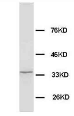 Anti-Morg1 antibody - Aminoterminal end (ab65870) at 1 µg/ml + rat brain tissue lysate