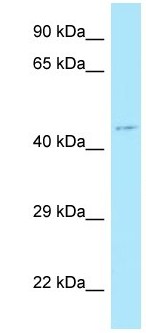 Anti-Motilin receptor antibody (ab133749) at 1 µg/ml + HeLa cell lysate at 10 µg
