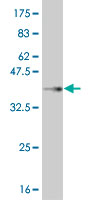 Western blot against tagged recombinant protein immunogen using ab55715 MOX1 antibody at 1ug/ml.