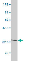 Western blot against tagged recombinant protein immunogen using ab56405 MPP5 antibody at 1ug/ml.