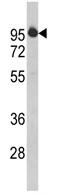 Anti-HIV TAT specific factor 1 antibody (ab90977) at 1/100 dilution + Jurkat cell lysate at 35 µg