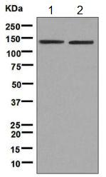 All lanes : Anti-HIV TAT specific factor 1 antibody [EPR9104(B)] (ab140654) at 1/1000 dilutionLane 1 : Jurkat cell lysateLane 2 : HeLa cell lysateLysates/proteins at 10 µg per lane.SecondaryGoat anti-rabbit HRP at 1/2000 dilution