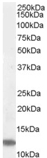 Anti-MPS1 antibody (ab4385) at 0.05 µg/ml + Jurkat lysate (35µg protein in RIPA buffer).